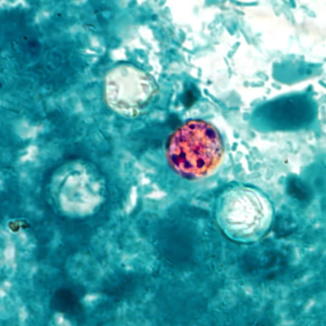 Michigan Officials Say Lettuce or Salad Greens May Be Source of Cyclospora Outbreak